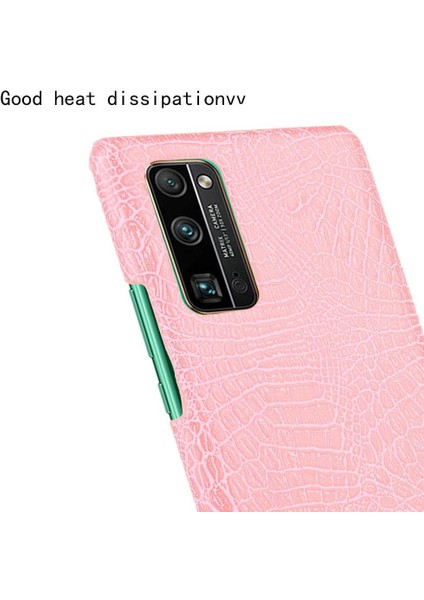 Onur 30 Pro Klasik Timsah Moda Koruyucu Için Şık Klasik Durumda (Yurt Dışından) modelleri