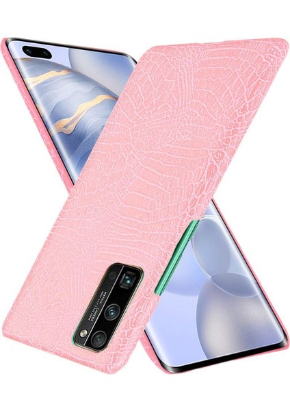 Onur 30 Pro Klasik Timsah Moda Koruyucu Için Şık Klasik Durumda (Yurt Dışından) fırsatları
