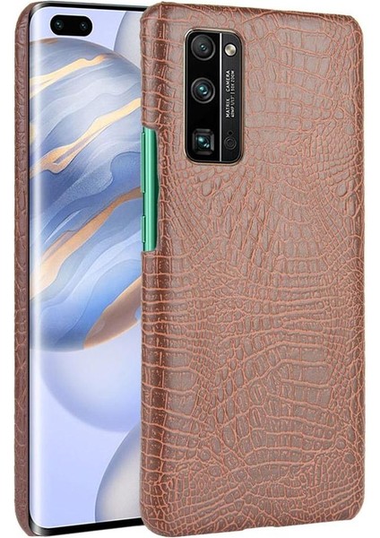 Onur 30 Pro Klasik Timsah Moda Koruyucu Için Şık Klasik Durumda (Yurt Dışından)