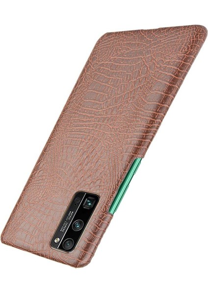 Onur 30 Pro Klasik Timsah Moda Koruyucu Için Şık Klasik Durumda (Yurt Dışından) modelleri
