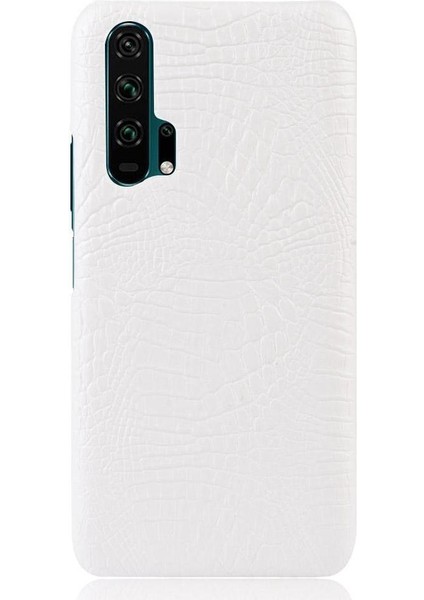 Onur 20 Pro Klasik Timsah Moda Koruyucu Için Şık Klasik Durumda (Yurt Dışından)