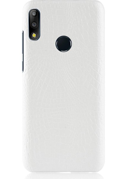 SZY Mall Asus Zenfone Max Pro M2 ZB631KL Koruyucu Kapak Için Şık Klasik Kılıf (Yurt Dışından)