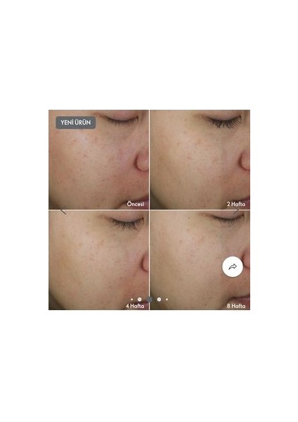 Novage+ Karma Bright Intense Rutini fiyatları