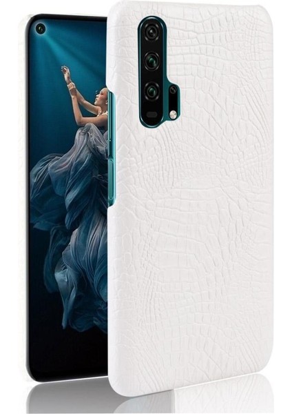 Onur 20 Pro Klasik Timsah Moda Koruyucu Için Şık Klasik Durumda (Yurt Dışından)