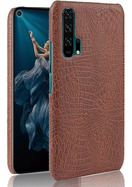 Onur 20 Pro Klasik Timsah Moda Koruyucu Için Şık Klasik Durumda (Yurt Dışından)