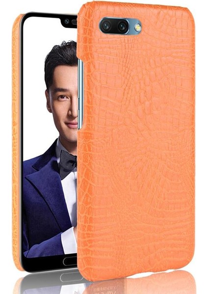 Onur 10 Anti Scratch Klasik Timsah Moda Için Şık Klasik Durumda (Yurt Dışından)