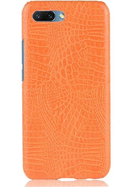 Onur 10 Anti Scratch Klasik Timsah Moda Için Şık Klasik Durumda (Yurt Dışından) fırsatları