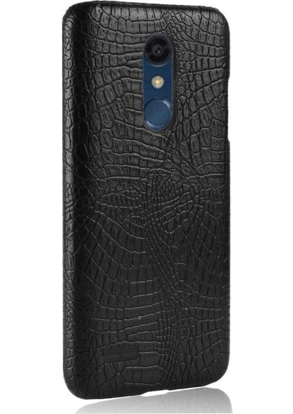 Lg K10 2018 Koruyucu Kapak Için Şık Klasik Kılıf Anti Scratch Klasik (Yurt Dışından) modelleri
