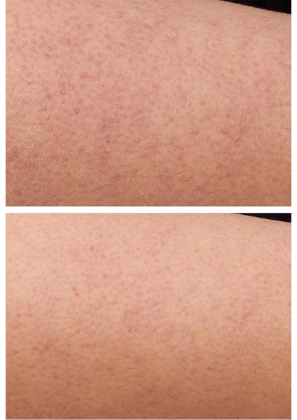 Kp Care Texture Smoothing Vücut Kremi 200ml