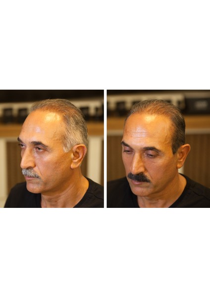 Fixwhite Beyazlık Kapatıcı Rötuş Kalemi 20 ml | Saç, Sakal, Bıyık Beyazlık Kapatıcı | Fixplant indirimleri