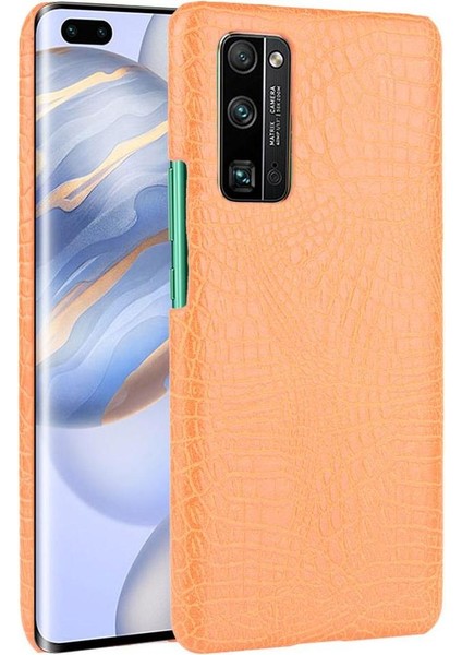 Onur 30 Pro Klasik Timsah Moda Koruyucu Için Şık Klasik Durumda (Yurt Dışından)