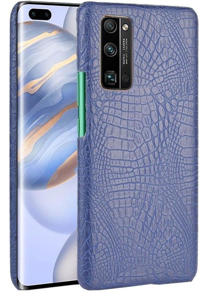 Onur 30 Pro Klasik Timsah Moda Koruyucu Için Şık Klasik Durumda (Yurt Dışından)