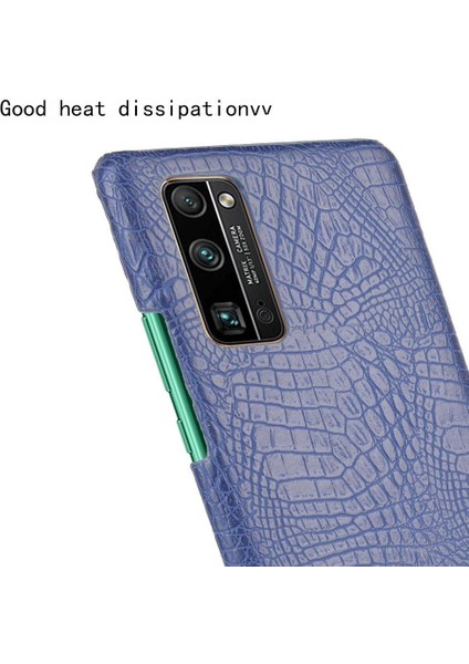 Onur 30 Pro Klasik Timsah Moda Koruyucu Için Şık Klasik Durumda (Yurt Dışından) fırsatları