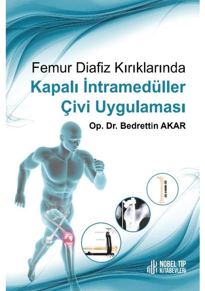 Femur Diafiz Kırıklarında Kapalı İntramedüller Çivi Uygulaması
