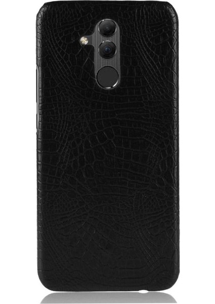 SZY Mall Huawei Mate 20 Lite Için Şık Klasik Durumda Koruyucu Kapak Klasik Anti (Yurt Dışından)