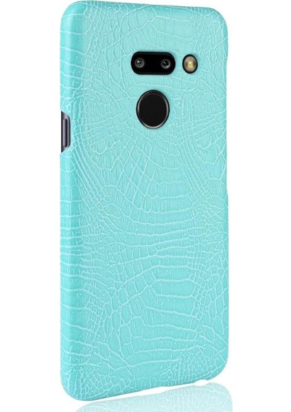 SZY Mall Lg G8 Thinq Klasik Timsah Moda Koruyucu Için Şık Klasik Durumda (Yurt Dışından)