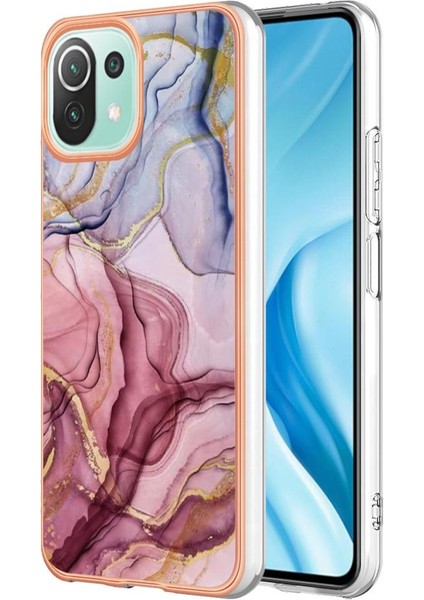 Xiaomi 11 Lite 5g Durumda ile Uyumlu (Yurt Dışından)