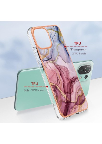Xiaomi 11 Lite 5g Durumda ile Uyumlu (Yurt Dışından)