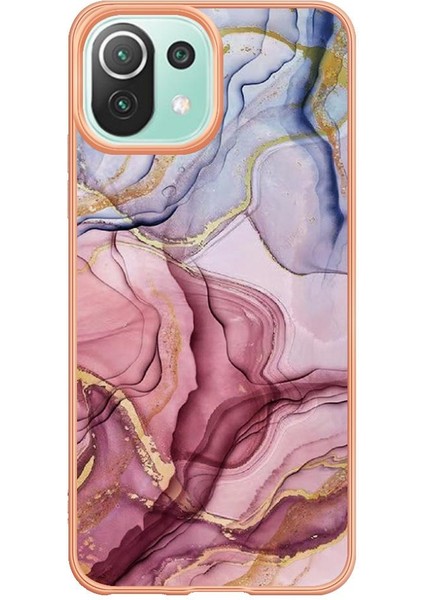 Xiaomi 11 Lite 5g Durumda ile Uyumlu (Yurt Dışından)