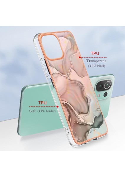 Xiaomi 11 Lite 5g Durumda ile Uyumlu (Yurt Dışından)