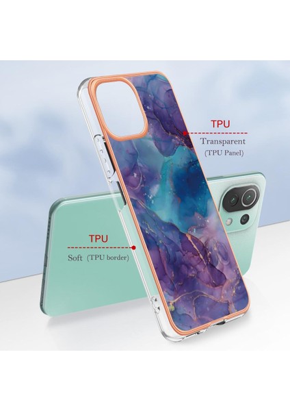Xiaomi 11 Lite 5g Durumda ile Uyumlu (Yurt Dışından)