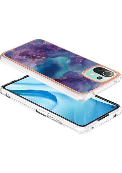 Xiaomi 11 Lite 5g Durumda ile Uyumlu (Yurt Dışından)