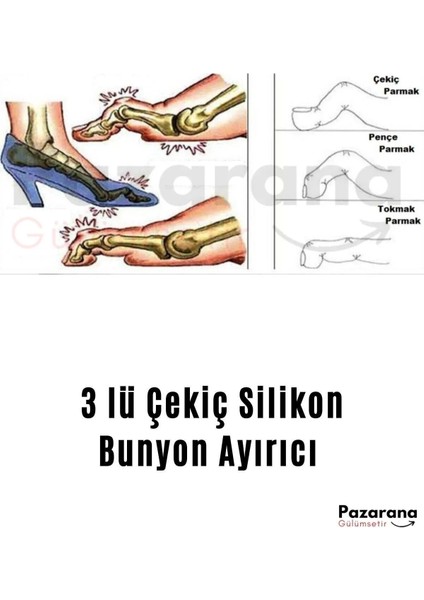 Silikon Çekiç Parmak Ayırıcı Şekil Bozukluk Giderici Yastık Çekiç Desteği Parmak Ayırıcı