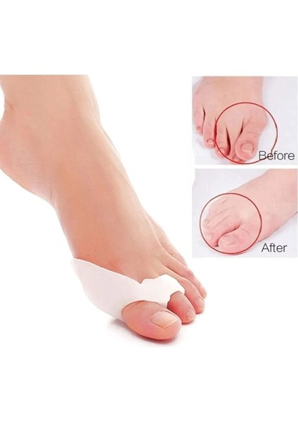 Iki Parmaklı Makaralı Bunyon Silikon fırsatları