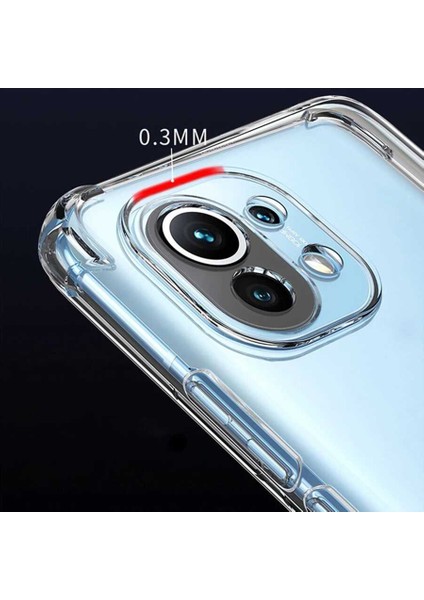 Xiaomi Mi 11 Lite Kılıf Kamera Korumalı Nitro Anti Shock Silikon-Renksiz