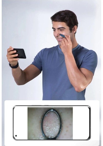 Siyah Nokta Temizleme Aletleri, Sivilce Sıkma Seti, 30x Büyütme Görünür Gözenek Temizleyici, Işıklı Ultra Hd Kamera, İçin Şarj Edilebilir Siyah Nokta Çıkarma Aleti
