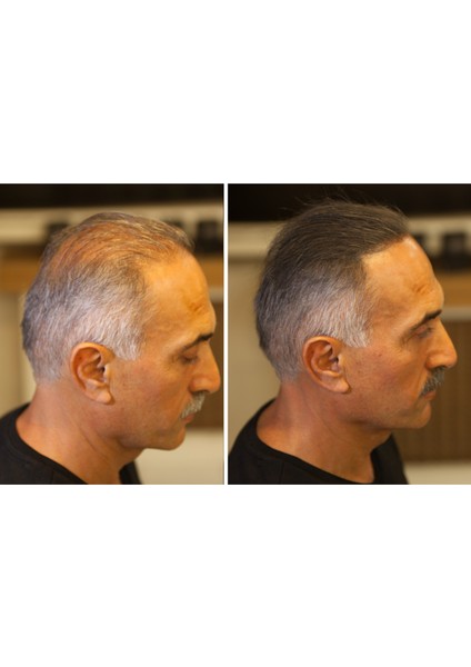 Fıxplant Saç Dolgunlaştırıcı 3 Şişe Topik 84 Gr. | Seyrek Saçlar Için Saç Tozu | Saç Fiberi fiyatları