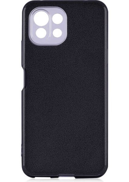 Xiaomi Mi 11 Lite Kılıf Shining Silikon-Siyah