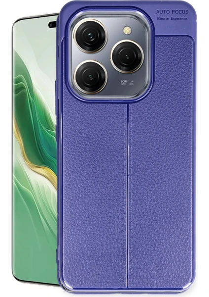 Denza Case Tecno Spark 20 Pro Kılıf Deri Görünümlü Premium Kapak - Lacivert