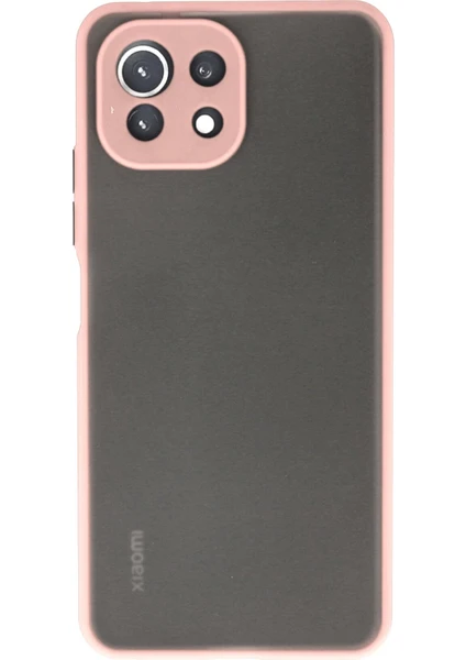 Denza Case Xiaomi Mi 11 Lite Kılıf Kenarları Renkli Mat Kapak - Pembe