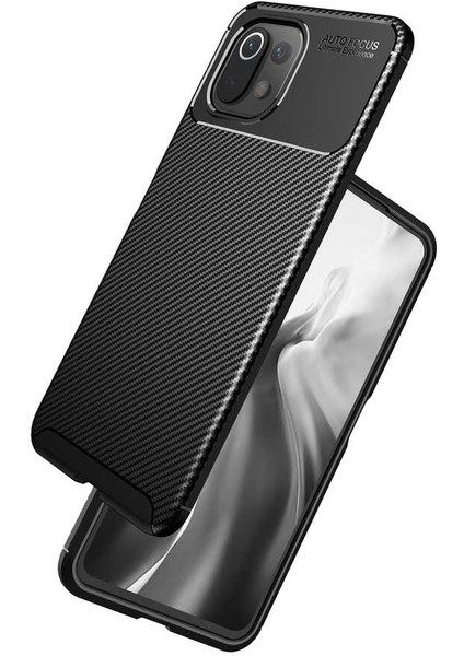 Xiaomi Mi 11 Lite Kılıf Negro Silikon Kapak-Kahverengi