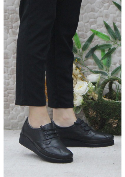 Mehmet Mete 4296 Siyah Deri Lastik Bağçıklı Kemik Çıkıntısına Özel Kadın Ayakkabı