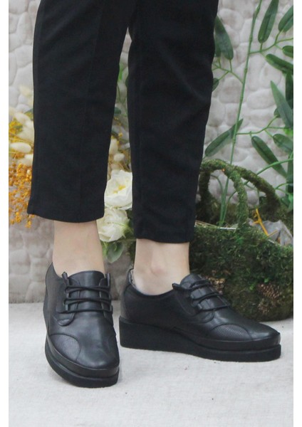 Mehmet Mete 4296 Siyah Deri Lastik Bağçıklı Kemik Çıkıntısına Özel Kadın Ayakkabı fiyatları