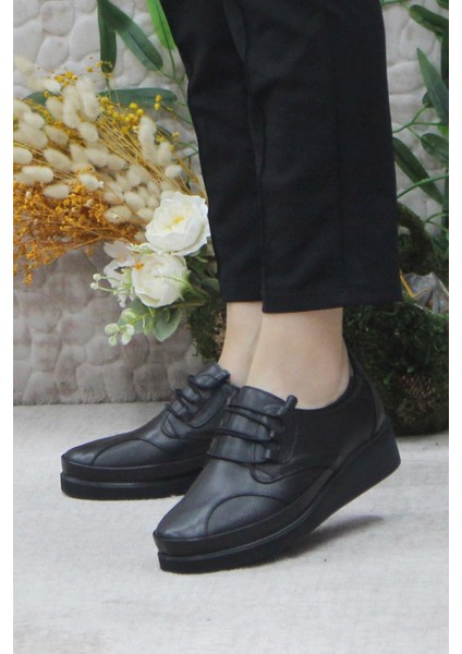 Mehmet Mete 4296 Siyah Deri Lastik Bağçıklı Kemik Çıkıntısına Özel Kadın Ayakkabı modelleri