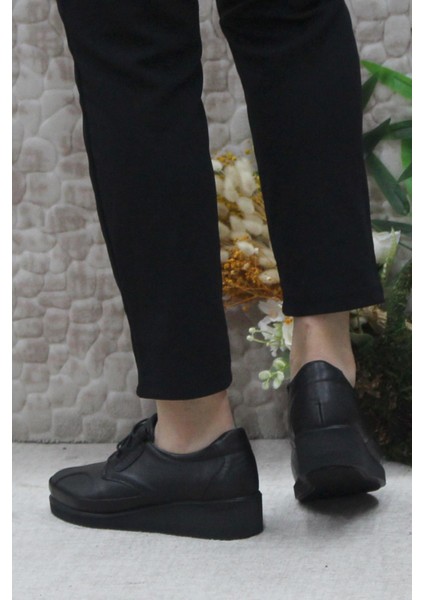Mehmet Mete 4296 Siyah Deri Lastik Bağçıklı Kemik Çıkıntısına Özel Kadın Ayakkabı fırsatları