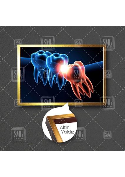 Ağız Diş Sağlığı Dişçi Diş Hekimi 20lık Dentist Çerçeveli Yatay Kanvas Tablo