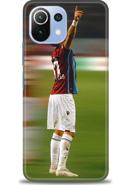 Xiaomi Mi 11 Lite Uyumlu Kılıf Hd Baskılı Kılıf /UPLOADVSLX(267) - 868
