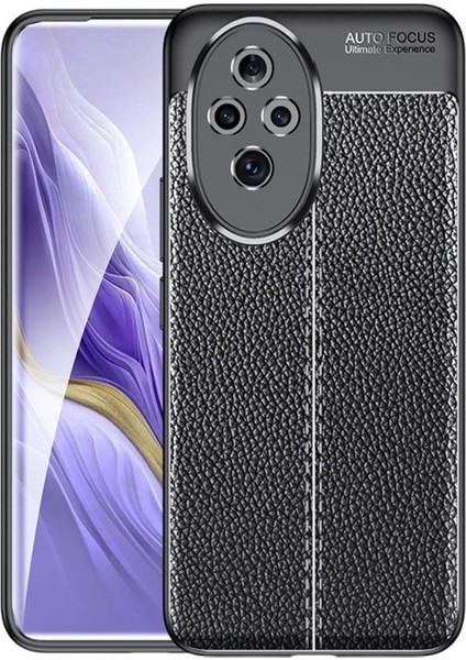 Honor 200 Pro Kılıf Niss Silikon Kamera Korumalı Deri Görünümlü Siyah