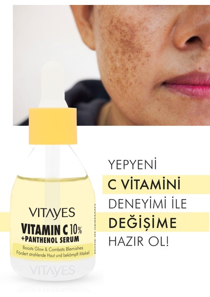 VITAYES C Vitamini %10 ve Panthenol Cilt Tonu Eşitleyici Leke Karşıtı Aydınlatıcı Nemlendirici Cilt Serumu 903