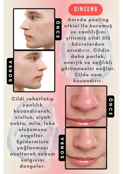 TO DO FIRST Ginseng Özlü Aydınlatıcı Yüz Peelingi Ölü Derilerden Arındırıcı Gözenek Temizleyici 100 ml