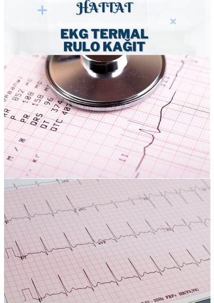 50 Adet Rulo Ekg Ecg 80MMX20METRE Tam Metrajlı Yüksek Kaliteli Hassas Karelajlı Rulo Termal Kağıt
