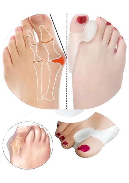 Jel Silikon Başparmak Ayak Ateli Düzeltici Koruyucu Makaralı Beyaz Ten Rengi 2'li Set fiyatları