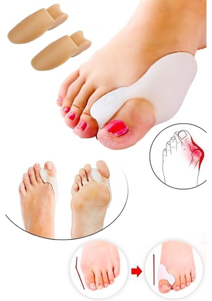 Bunion Kemik Koruyucu 2li Set Baş Parmak Kemik Çıkıntısı Önleyici