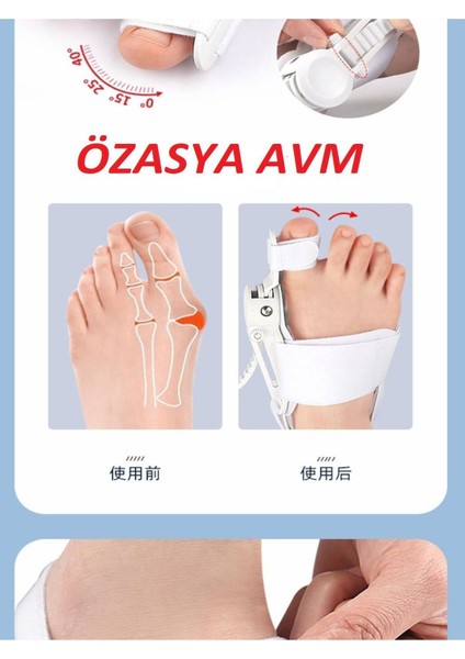 Ayarlı Ayak Baş Parmak Kemik Düzeltici Başparmak Eğriliği Düzeltme Gece Ateli