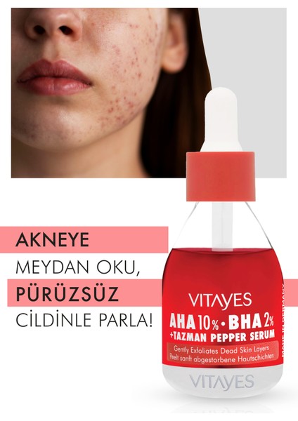 VITAYES Aha %10 Bha %2 Kırmızı Peeling Gözenek Sıkılaştırıcı Canlandırıcı Cilt Tonu Eşitleyici Cilt Serumu 900