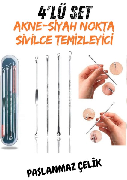 Akne-Siyah Nokta Temizleyici 4'lü Set Paslanmaz Çelik Garantili